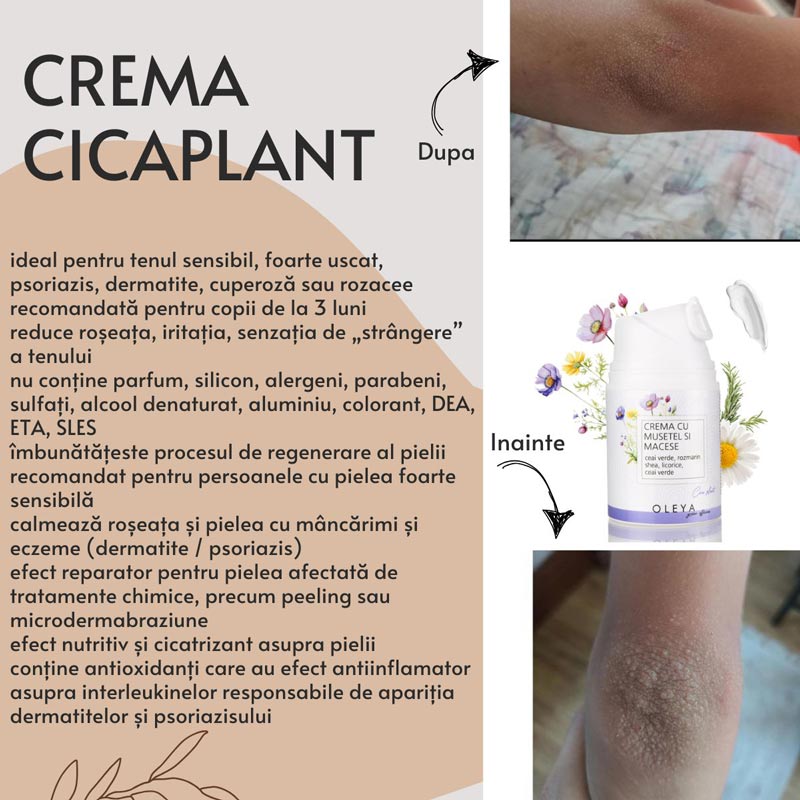 CicaPlant - Crema cicatrizanta cu Macese, Rozmarin si Musetel - Image 5