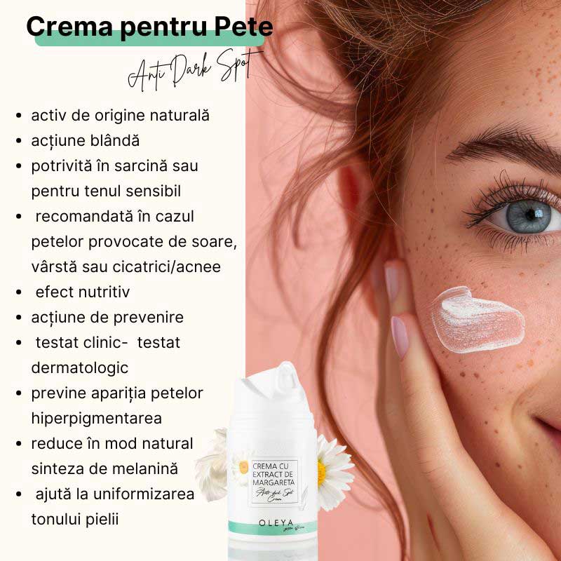 Anti Dark Spot Cream - Crema pentru Pete Pigmentare cu Extract de Margareta - Image 2