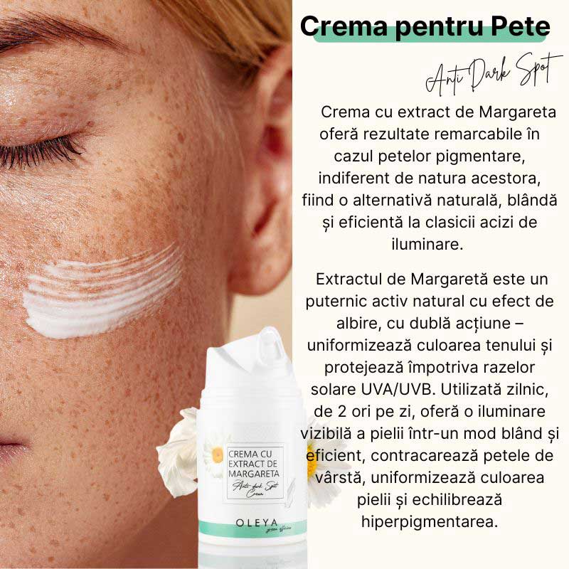 Anti Dark Spot Cream - Crema pentru Pete Pigmentare cu Extract de Margareta - Image 3