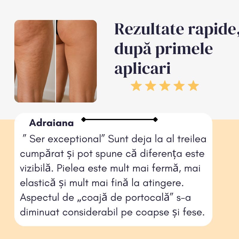 CelluControl Serum - Ser anticelulitic cu Venin de Vipera, Alge Marine si Scortisoara - imagine 4